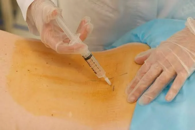 Riesgos de la cirugía de hernia de disco y alternativas no quirúrgicas para el tratamiento